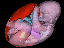 Reconstructed image of fetus & placenta.